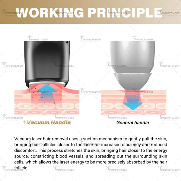 808nm diode laser advantages
