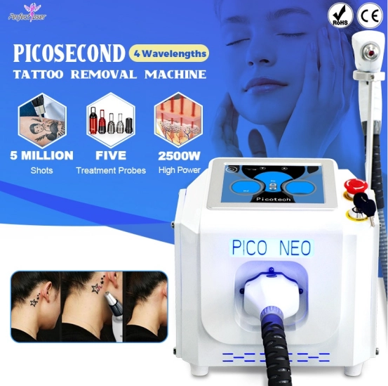 Portable Tattoo Removal Machine Trends and Innovations to Watch in 2026