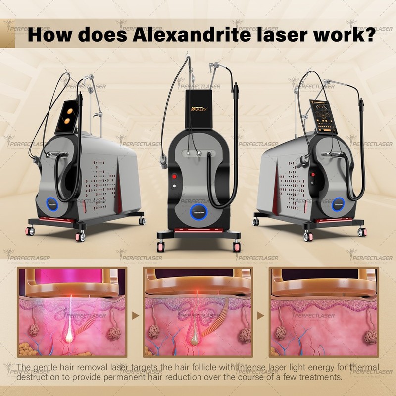 Alexandrite Laser Hair Removal Machine